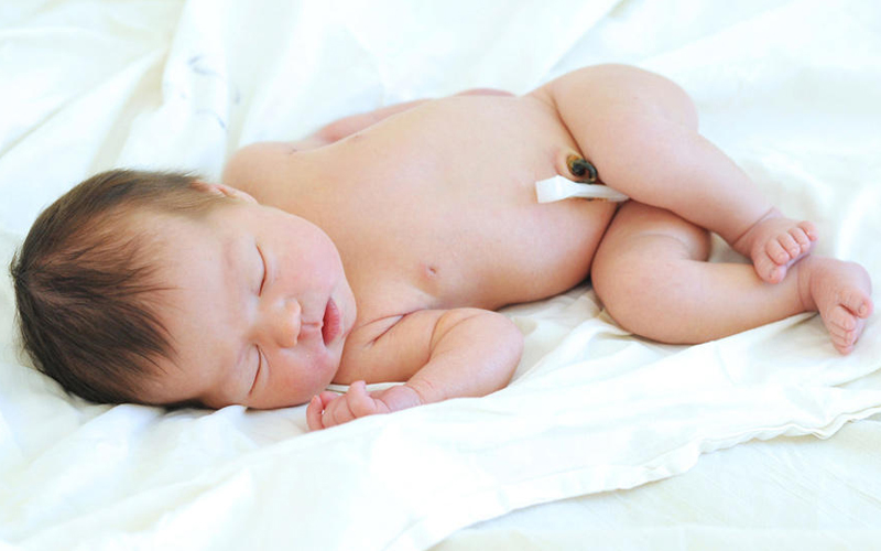 Como fazer a limpeza do coto umbilical?
