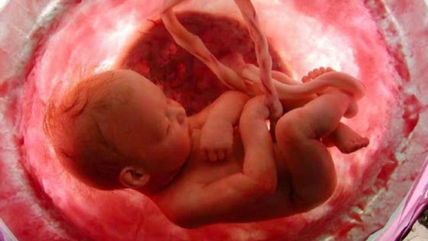 Plano de parto. Quando cortar o cordão umbilical?