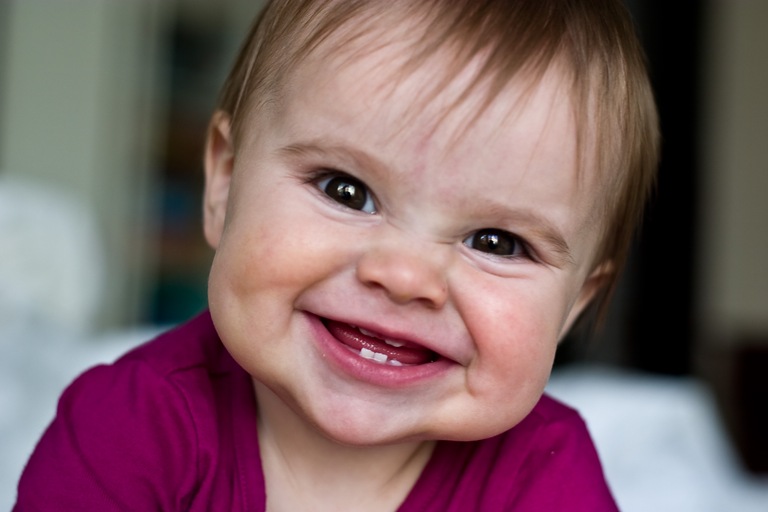Herpes infantil: O contágio mora nos gestos mais simples