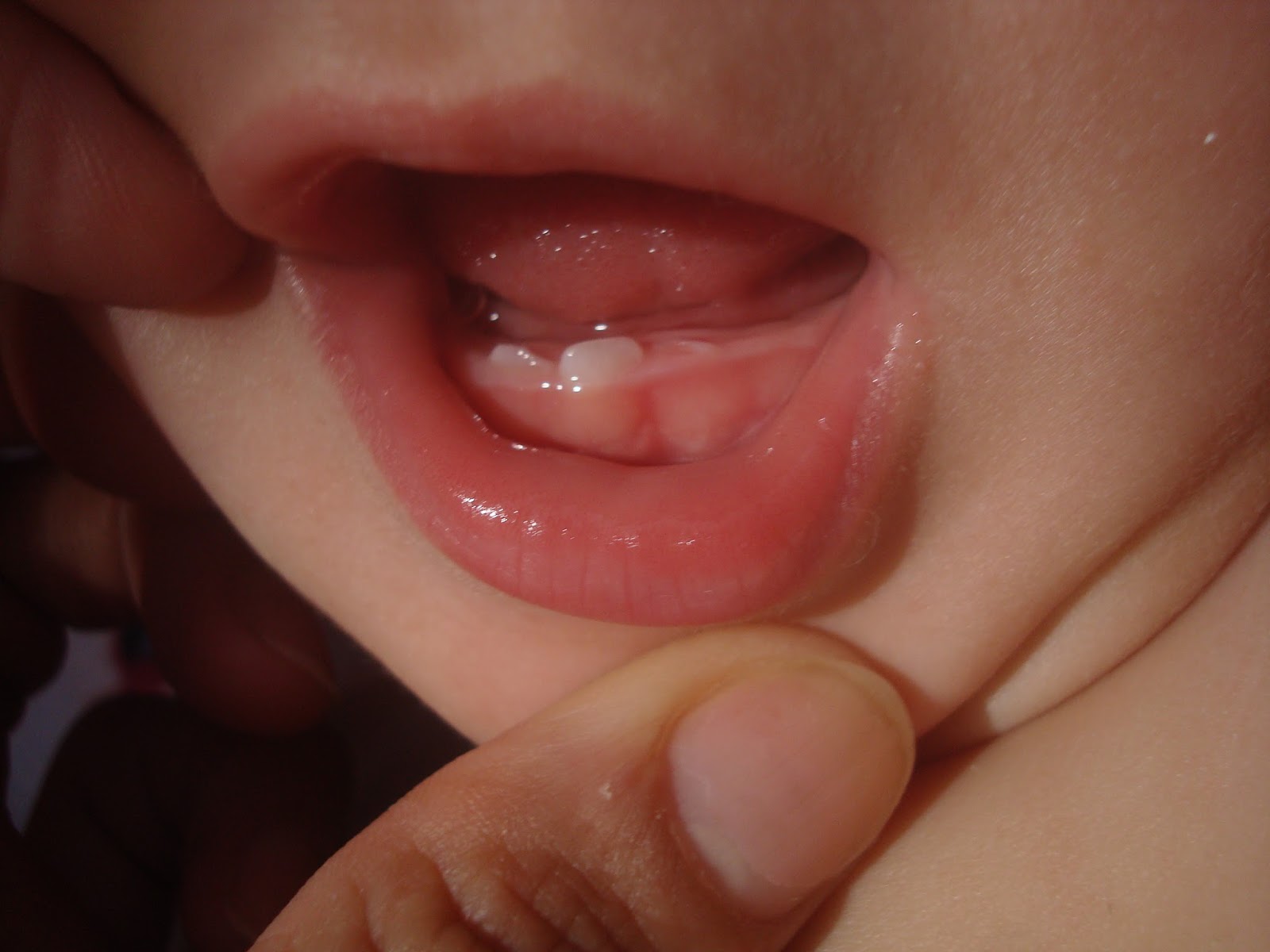 Como lidar com o nascimento dos dentes ?
