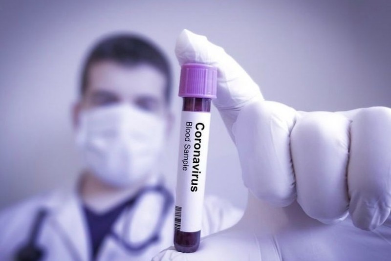 CORONAVÍRUS – o que você precisa saber e como se prevenir