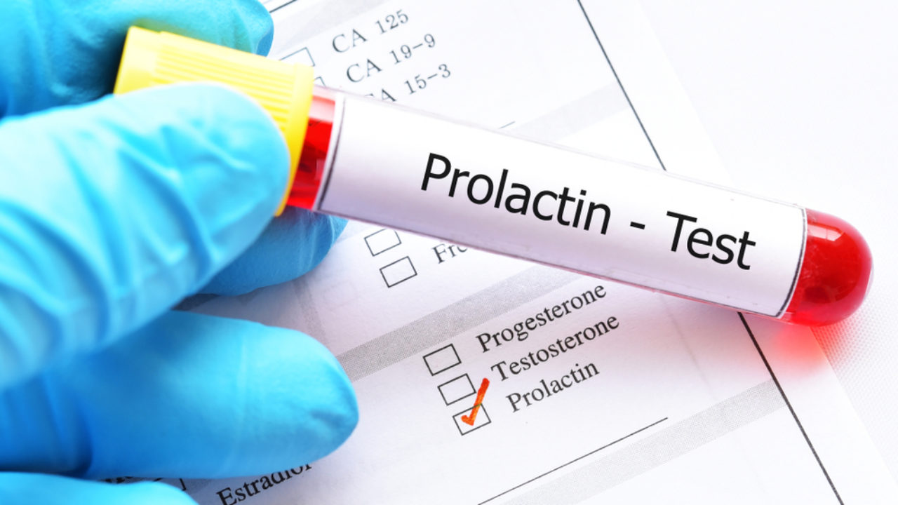 Prolactina – o que é? para que serve?